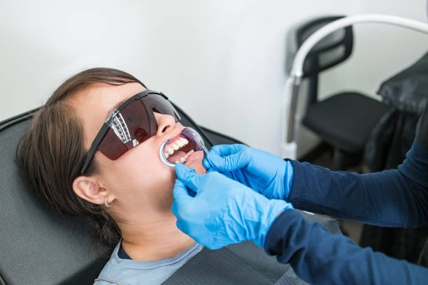 Best Knocked-Out Tooth (Avulsed Tooth) Treatment in Brentwood, NY